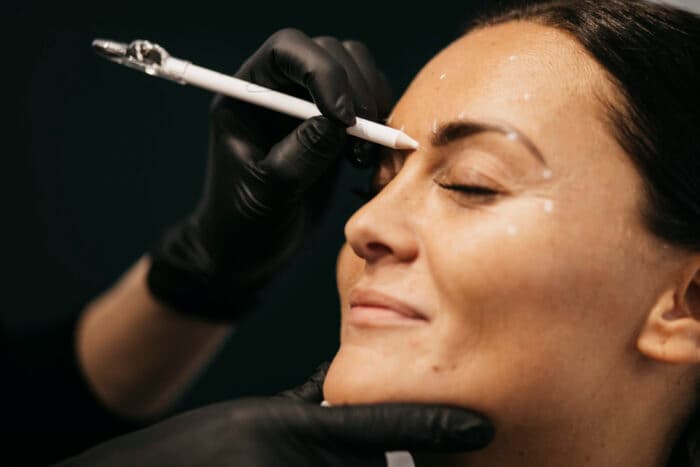 Botox behandling hos Studio A