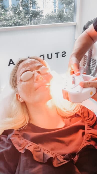 Avanceret IPL RF behandling til udjævning af akne, ar og forbedring af hudstruktur