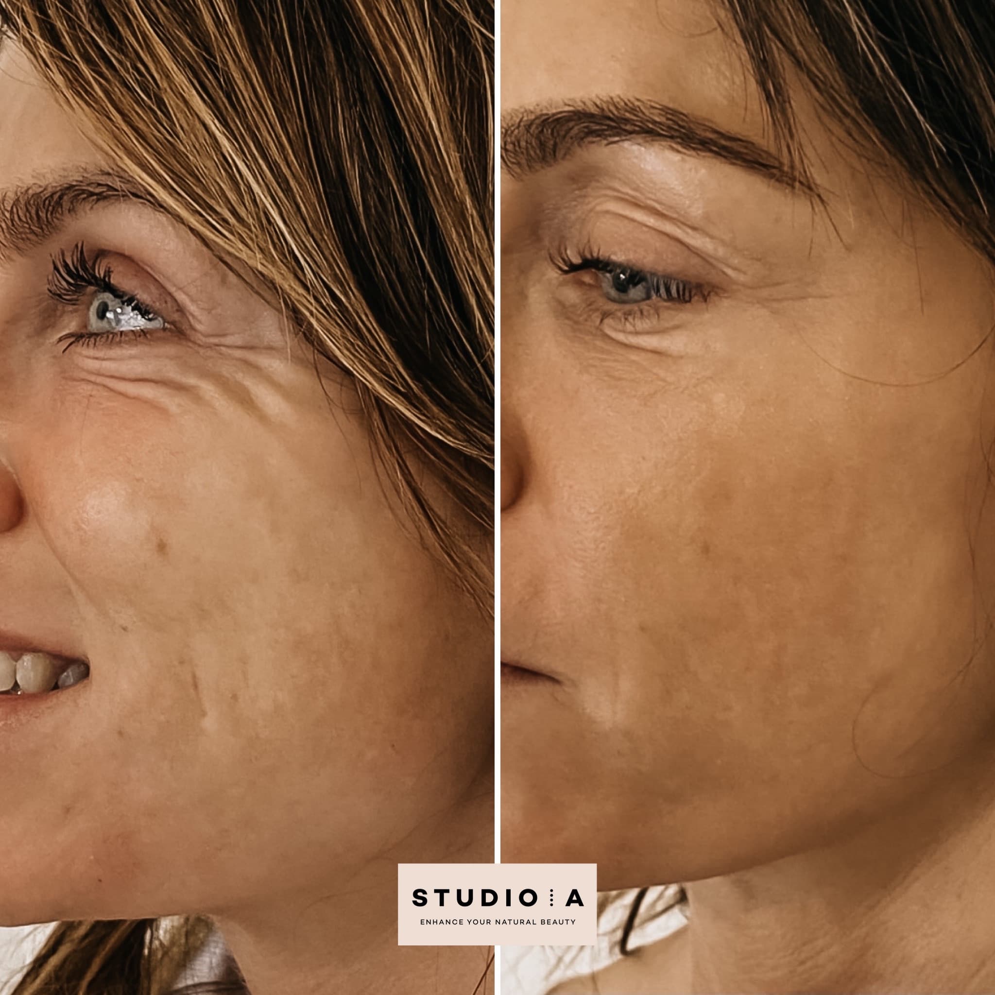 Skinbooster