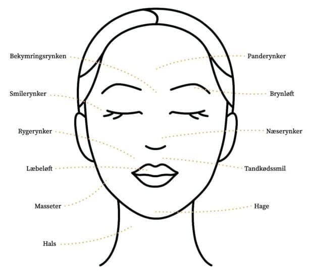 Behandlingsområder med botox