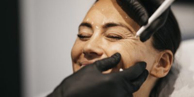 Botox behandling i Silkeborg - Camilla på 28